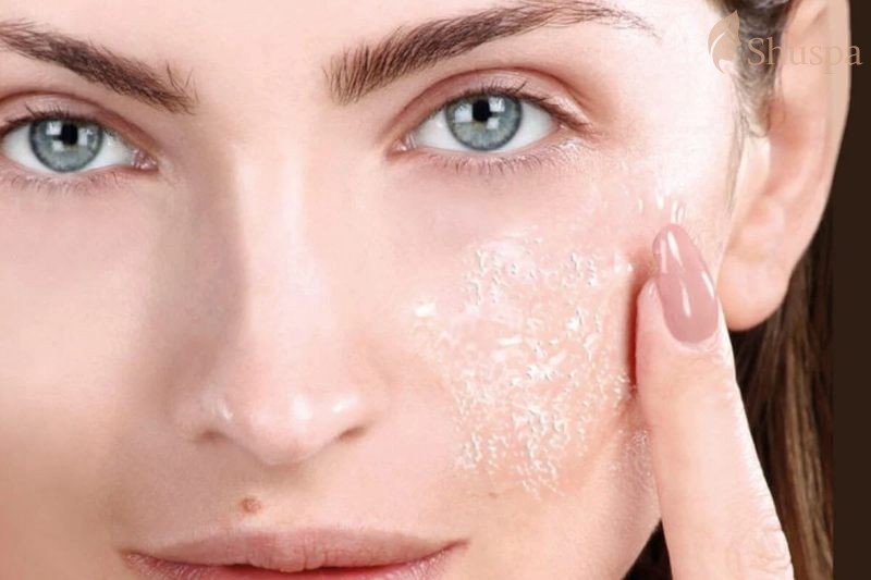 Peel da được chia làm nhiều loại, cần nắm vững và rõ các loại peel da để áp dụng phù hợp