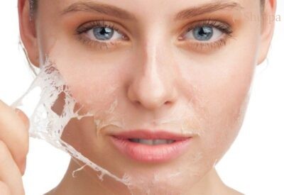 Có nên peel da mặt không? Những điều cần biết trước khi peel da mặt