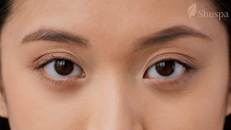 Giật lông mày phái nữ giúp tăng tính thẩm mỹ trên khuôn mặt