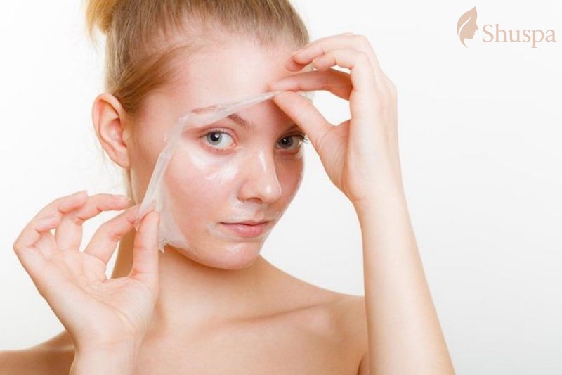 Peel da sinh học là gì? Cần chú ý những điều gì khi peel da sinh học