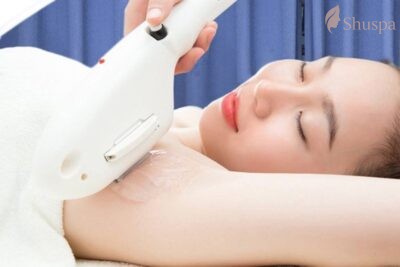 Triệt lông diode laser rất được ưa chuộng nhưng sẽ chỉ phù hợp với một số đối tượng