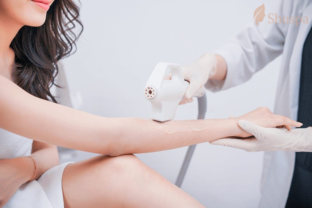 Một số lời khuyên khi lựa chọn dịch vụ triệt lông tại Hà Nội