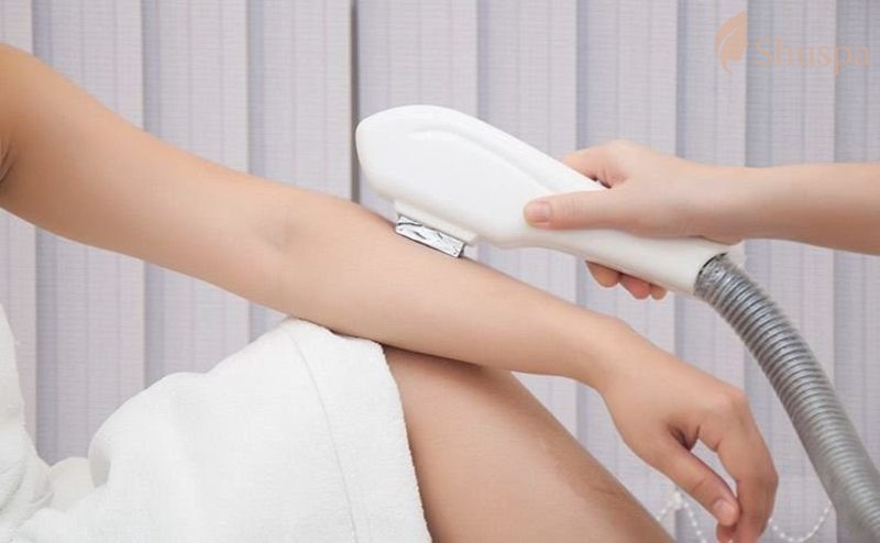 Quy trình chuẩn đối với triệt lông diode laser
