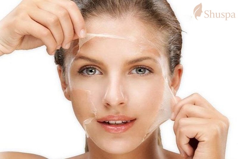 Cần lựa chọn sản phẩm peel da phù hợp với tình trạng da mặt của bạn
