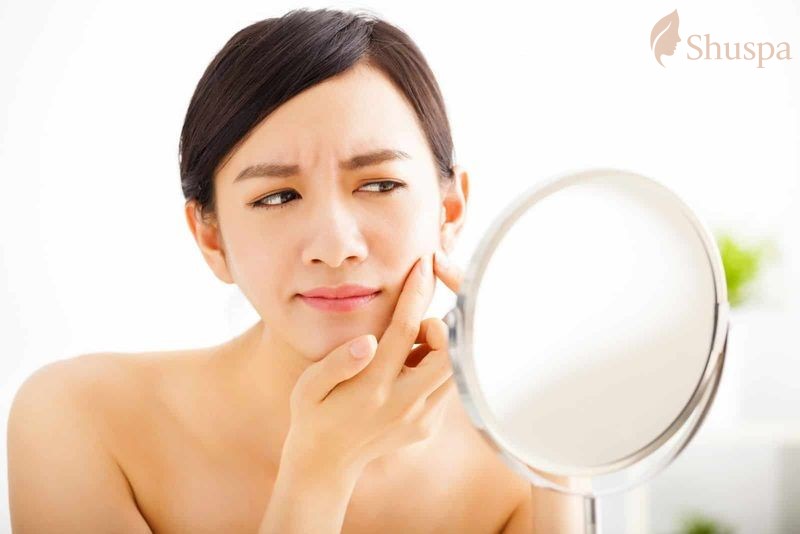 Cần có liệu trình chăm sóc da phù hợp theo mùa