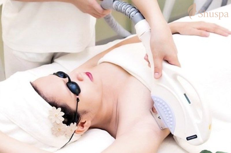 Một số vấn đề cần chăm sóc sau khi triệt lông diode laser