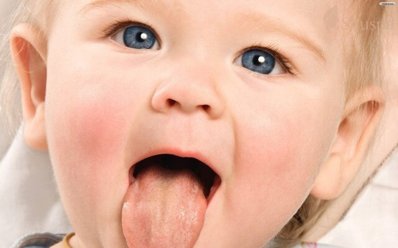 Mụn lưỡi ở trẻ em có gây nguy hiểm không và cách xử lý như thế nào?